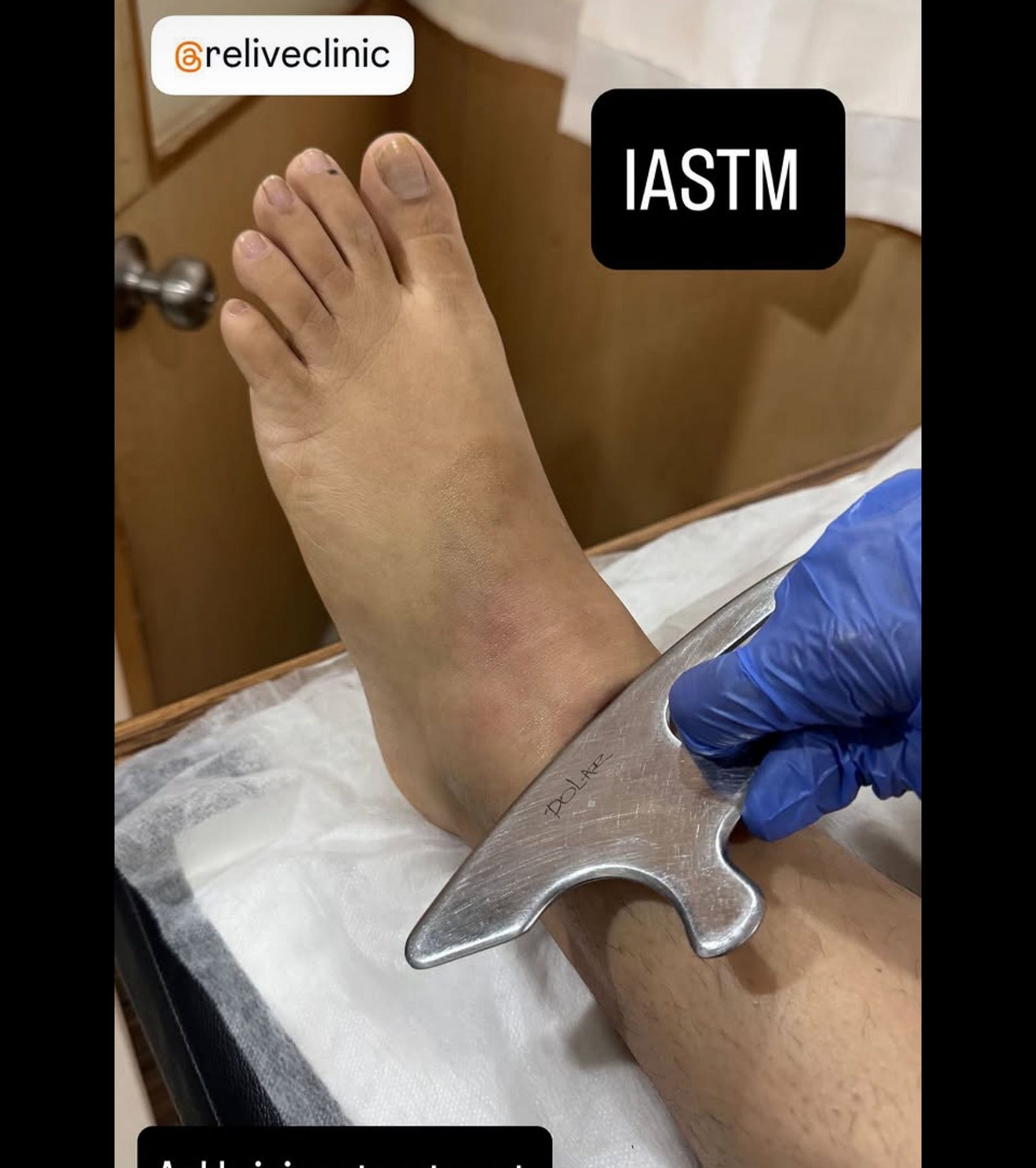 Pic of me doing ISTM in physiotherapy